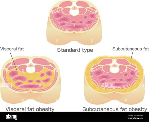 What Is Visceral Fat & How To Get Rid of It - Cleveland Clinic - balustradellc