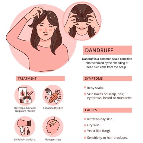What Makes Dandruff: Causes and How to Treat It - balustradellc