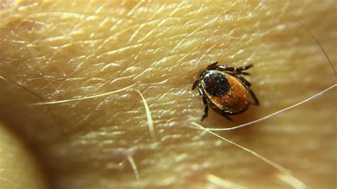 What to Do After a Tick Bite | Ticks | CDC - balustradellc