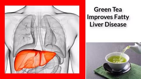 When To Drink Green Tea For Fatty Liver - balustradellc