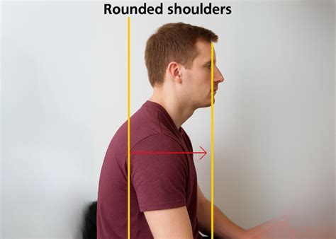 When you have a rounded/unstable shoulder. There’s a lot of ... - balustradellc