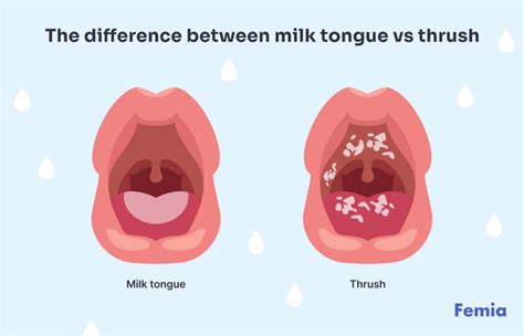 White tongue baby: Lebih dari 26 ribu Foto Stok yang Dapat Dibeli ... - balustradellc