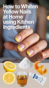 Whiten Yellow Nails at Home With These Amazing Hacks - balustradellc