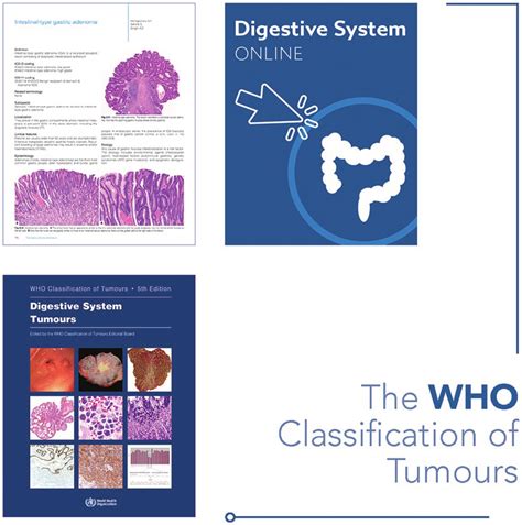 WHO Classification of Tumours Online.