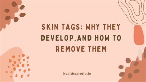 Why do skin tags develop and how to remove them - balustradellc
