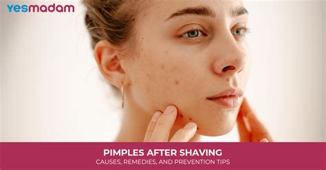 Why Pimples Pop Up After Shaving and How to Prevent Them - balustradellc