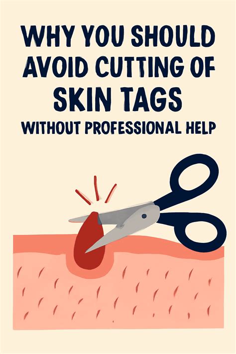 Why Skin Tags Happen and How to Avoid Them - balustradellc