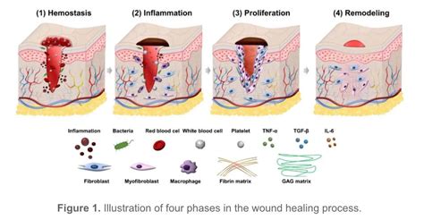 Wound healing through the ages - PMC - wintechmobiles.com
