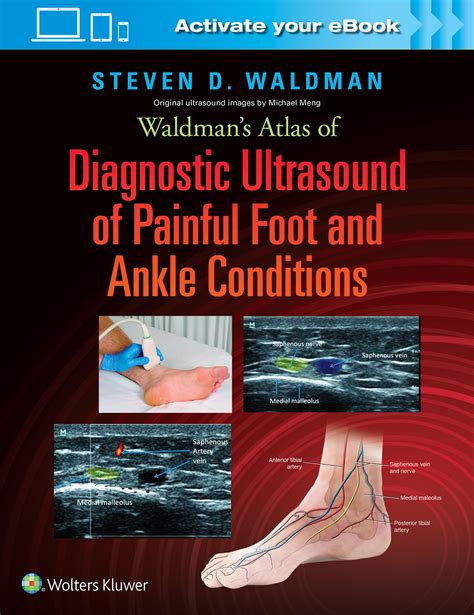 Download Waldmans Atlas Of Diagnostic Ultrasound Of Painful Foot And Ankle Conditions By Steven D Waldman