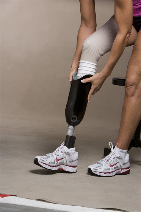 While getting ready for the prosthetic leg, you need to keep 5 things in mind. Correct positioning of your residual limb. Muscle stretching and strengthening. Touch and desensitization. Residual limb shaping. Daily limb care and hygiene. In order to avoid any further problems, follow the above 5 points regularly.