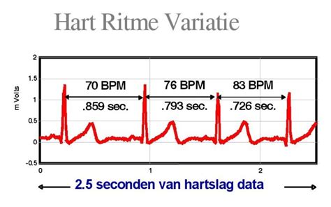 Wat is coherentie in Heartmath