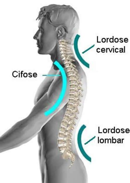 Wat is een verstreken cervicale lordose? – KorteAntwoorden