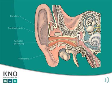 Wat te doen bij otitis externa