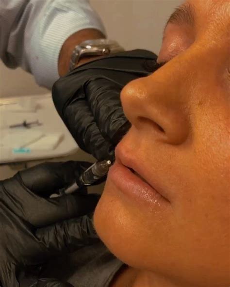 We are still taking Botox/Filler... Lloyd D Landsman MD