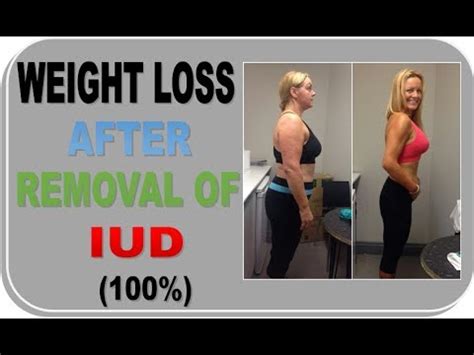 Weight loss after iud removal. Diets are only effective if your body never thinks the diet is over. Obesity is a risk factor for numerous disorders that afflict the human race, so understanding how to maintain a... 