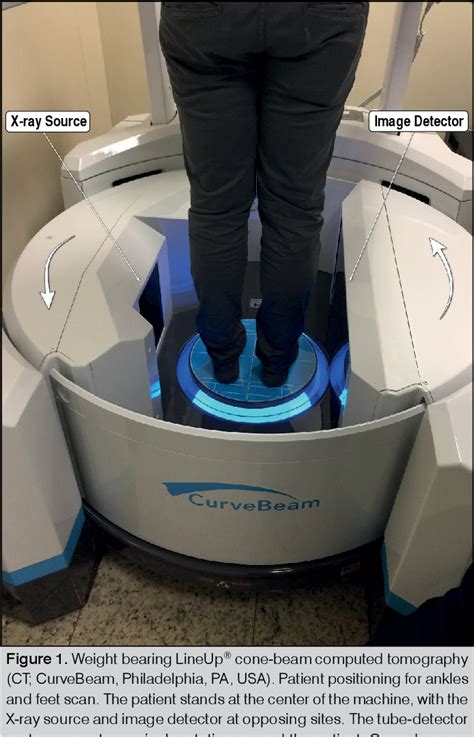 Weight-Bearing Cone-Beam CT Scan Assessment of Stability of …