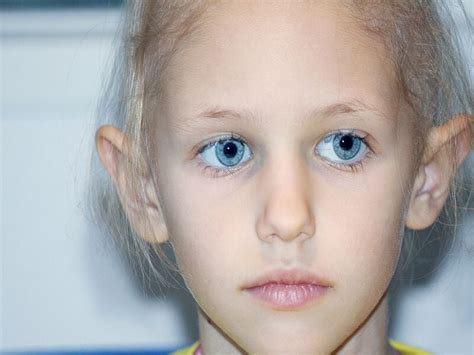 What’s the Life Expectancy for Childhood Cancer …