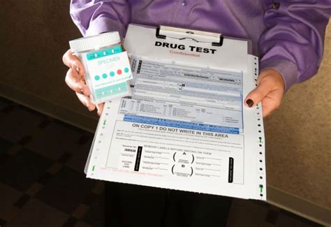 What Are Probation Drug Testing Procedures Barkemeyer Law Firm