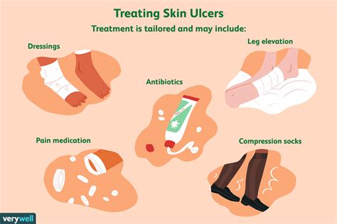 What Are Skin Ulcers—And How Are They Treated?