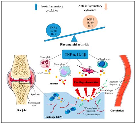 What Are The Markers For Rheumatoid Arthritis