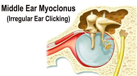 What Causes A Clicking Sound In Your Ear? - WWFAQs