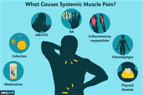 What Causes Muscle Aches & Pains? Advil