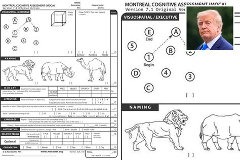 What Cognitive Test Did President Donald Trump …