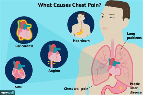 What Does Chest Pain Mean 