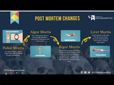 What Happens After Death? Pallor, Algor, Rigor & Livor Mortis