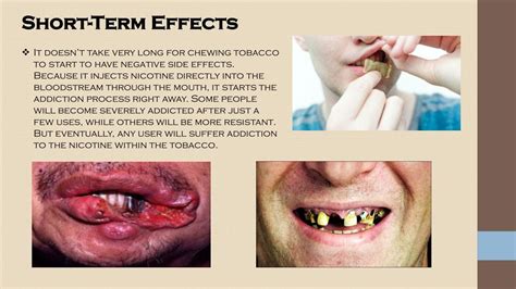 What Happens if You Swallow Tobacco Chew: The Damaging Effects