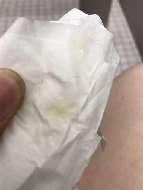 What Is A Normal Discharge Before Period Printable Templates Free