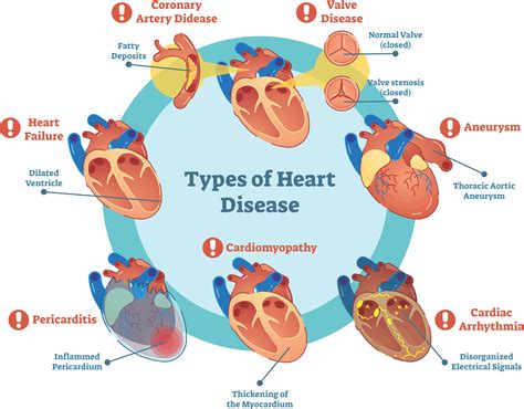 What Is Cardiac Health