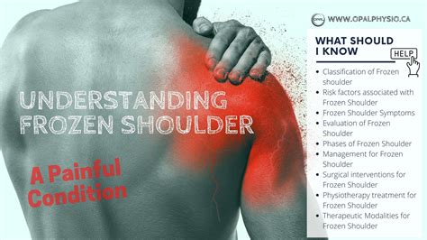 What Is Frozen Shoulder? - Health