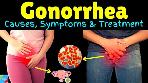 What Is Gonorrhea? Symptoms, Causes, Diagnosis, …