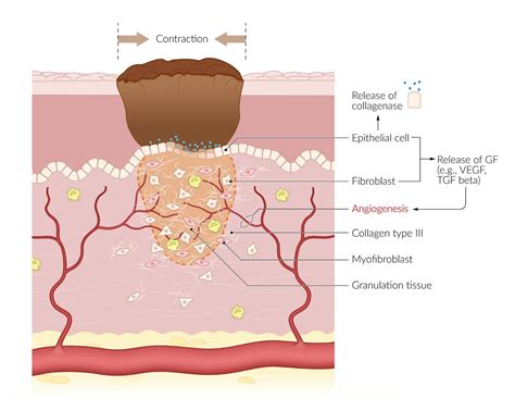 What Is Granulation & Jewellery Designs We Love