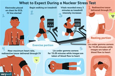 What Is Nuclear Stress Testing