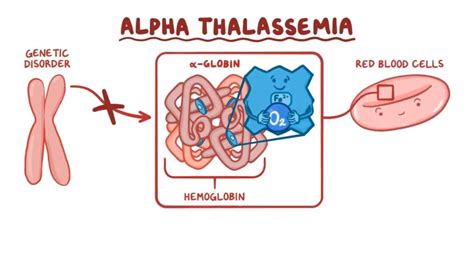 What Is Thalassemia? SEA