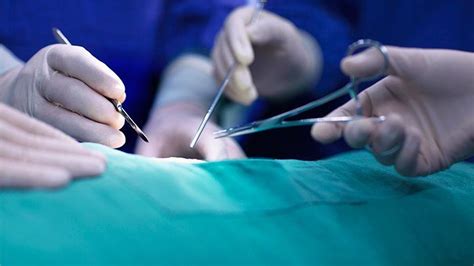 What Is an Appendectomy Surgery and Recovery Everyday Health