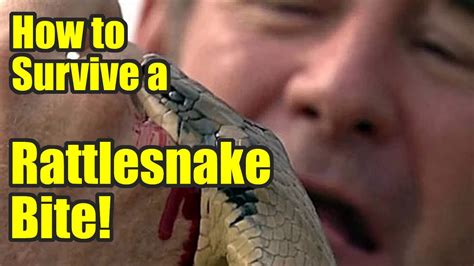 What NOT to do if you're bitten by a rattlesnake