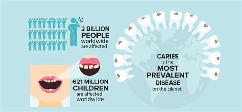 What Percentage of People Have Cavities?