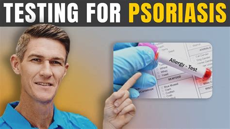 What Testing to get for Psoriasis How to know why you have Psoriasis
