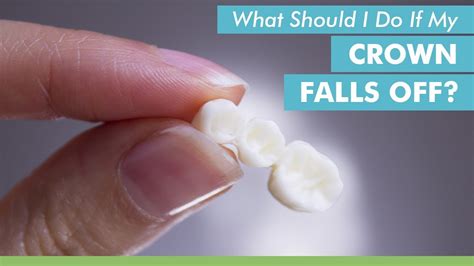 What To Do if Your Crown Falls Off - elizabethlwakimdds.com