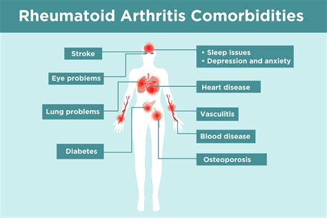 What You Need to Know About Rheumatoid Arthritis