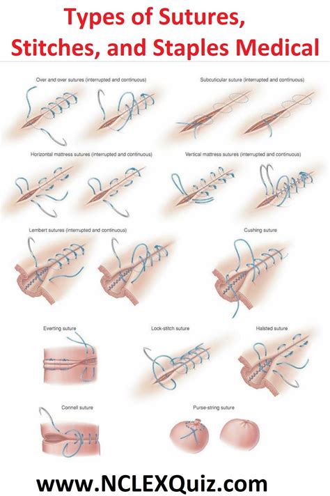 What a difference a week makes! – Stitches of Time