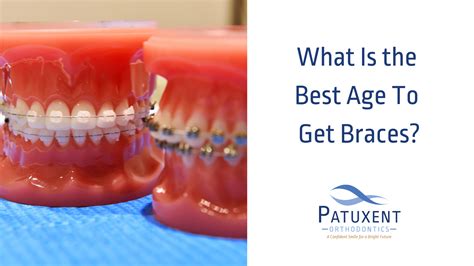 What age should i get braces