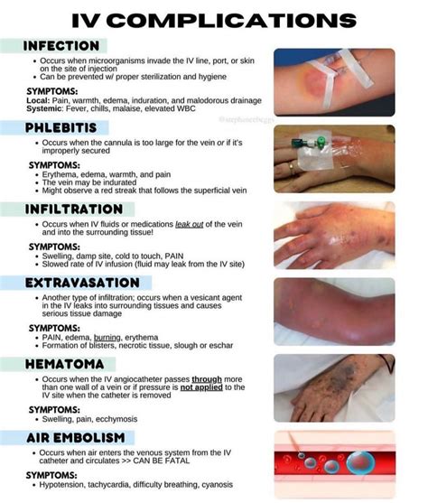 What are the 8 sites for iv injection.  Potential complications are also ...