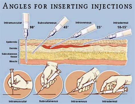 What are the 8 sites for iv injection. .  ...