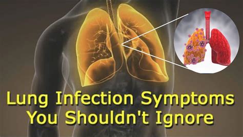 What are the Symptoms of a Fungal Infection of the Lungs?