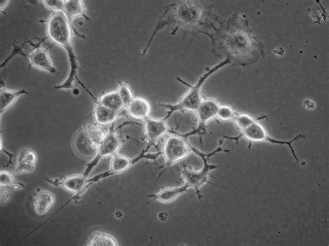 What are the details of N2A cell differentiation methods?