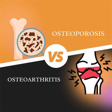 What are the differences between arthritis and osteoporosis 